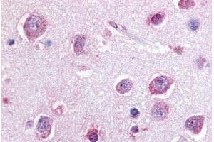 Human Brain, Cortex (formalin-fixed, paraffin-embedded) stained with P2RY8 antibody ABIN213464 at 20 ug/ml followed by biotinylated goat anti-rabbit IgG secondary antibody ABIN481713, alkaline phosphatase-streptavidin and chromogen. (P2RY8 antibody  (C-Term))