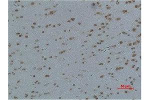 Immunohistochemical analysis of paraffin-embedded Rat Brain Tissue using L-type Ca++ CP γ4 Polyclonal Antibody. (CACNG4 antibody)