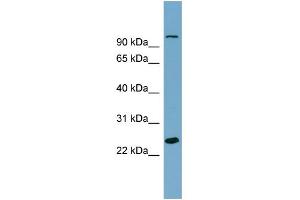 WB Suggested Anti-SEMA3D Antibody Titration: 0.