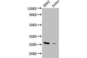 Western Blot Positive WB detected in: K562 whole cell lysate, Jurkat whole cell lysate All lanes: MOB1A antibody at 3. (MOB1A antibody  (AA 2-216))