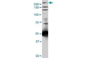 TLN1 monoclonal antibody (M05), clone 5C1. (TLN1 antibody  (AA 1052-1149))