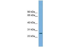 WB Suggested Anti-RAB35 Antibody Titration: 0. (RAB35 antibody  (Middle Region))