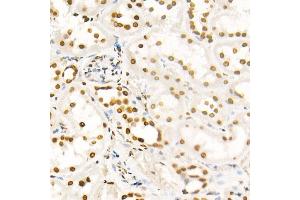 Immunohistochemistry of paraffin-embedded rat ovary using H4K8ac antibody (ABIN7267747) at dilution of 1:100 (40x lens). (Histone H4 antibody  (acLys8))