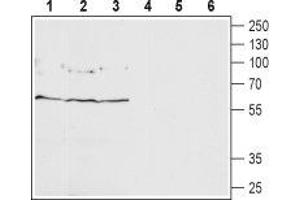 Western blot analysis of rat brain (lanes 1 and 4), rat cerebellum (lanes 2 and 5) and mouse brain (lanes 3 and 6): - 1-3. (GABRD antibody  (Extracellular, N-Term))