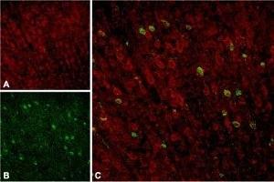 Expression of Sortilin in rat neocortex - Immunohistochemical staining of rat neocortex with Anti-Sortilin (extracellular) Antibody (ABIN7043768, ABIN7044759 and ABIN7044760). (Sortilin 1 antibody  (Extracellular Domain))