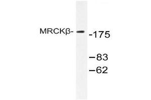 Western blot (WB) analysis of MRCKβ antibody in extracts from COLO cell. (CDC42BPB antibody)