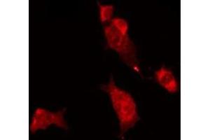 ABIN6275434 staining MCF7 by IF/ICC. (RAB11FIP2 antibody  (Internal Region))