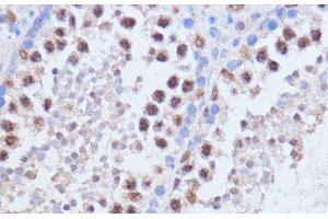 Immunohistochemistry of paraffin-embedded Mouse testis using BRD4 Polyclonal Antibody at dilution of 1:100 (40x lens). (BRD4 antibody)