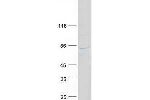 Validation with Western Blot