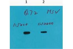 Western Blotting (WB) image for anti-HSV Tag antibody (ABIN3178666) (HSV Tag antibody)
