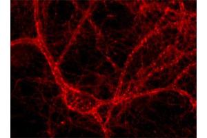 Immunocytochemistry on cultured hippocampus neurons (dilution 1 : 500). (Amphiphysin antibody  (AA 2-15))