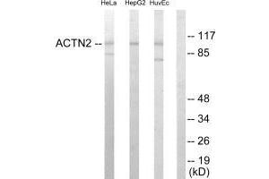Western blot analysis of extracts from HeLa cells, HepG2 cells and HUVEC cells, using Actin α-2/3 antibody. (ACTN3 antibody  (N-Term))