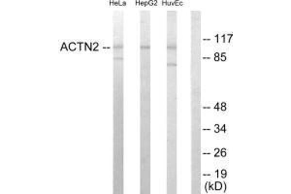 ACTN3 抗体  (N-Term)