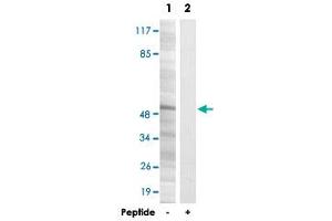 Western blot analysis of extracts from MCF-7 cells, using RRP8 polyclonal antibody . (RRP8 antibody)