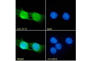 (ABIN185551) Immunofluorescence analysis of paraformaldehyde fixed A431 cells, permeabilized with 0.