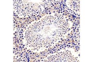 Immunohistochemistry analysis of paraffin-embedded mouse brain using TESK1 (ABIN7075866) at dilution of 1: 500 (TESK1 antibody)