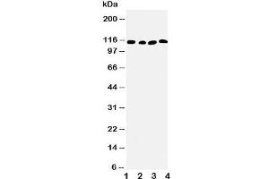 Western blot testing of SERCA2 ATPase antibody and Lane 1:  rat skeletal muscle;  2: rat kidney;  3: human PANC;  4: SMMC-7721 cell lysate. (SERCA2 ATPase (Middle Region) antibody)