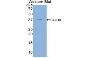Western Blotting (WB) image for anti-Fms-Related Tyrosine Kinase 4 (FLT4) (AA 30-326) antibody (ABIN3205873) (FLT4 antibody  (AA 30-326))