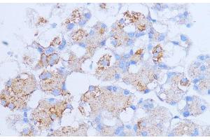 Immunohistochemistry of paraffin-embedded Rat pancreas using NME6 Polyclonal Antibody at dilution of 1:100 (40x lens).