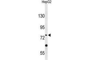 Western blot analysis of PLA2G6 (arrow) in HepG2 cell line lysates (35ug/lane) using PLA2G6  (PLA2G6 antibody  (Middle Region))