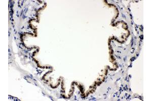 Immunohistochemistry (IHC) image for anti-Bone Morphogenetic Protein 5 (BMP5) (AA 332-365), (C-Term) antibody (ABIN3043800)