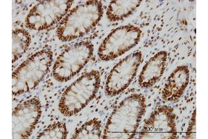 Immunoperoxidase of monoclonal antibody to SF1 on formalin-fixed paraffin-embedded human colon. (Splicing Factor 1 antibody  (AA 1-110))