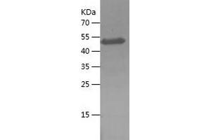 Western Blotting (WB) image for Melanoma Antigen Family C, 2 (MAGEC2) (AA 1-145) protein (His-IF2DI Tag) (ABIN7123899) (MAGEC2 Protein (AA 1-145) (His-IF2DI Tag))