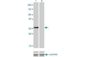Western blot analysis of MYOG over-expressed 293 cell line, cotransfected with MYOG Validated Chimera RNAi (Lane 2) or non-transfected control (Lane 1). (Myogenin antibody  (AA 1-224))
