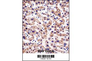 HTATIP2 Antibody immunohistochemistry analysis in formalin fixed and paraffin embedded human liver tissue followed by peroxidase conjugation of the secondary antibody and DAB staining. (HIV-1 Tat Interactive Protein 2, 30kDa (HTATIP2) (AA 45-74), (N-Term) antibody)