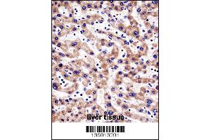 Immunohistochemistry (IHC) image for anti-HIV-1 Tat Interactive Protein 2, 30kDa (HTATIP2) (AA 45-74), (N-Term) antibody (ABIN5531349)