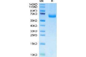 Mouse Alkaline Phosphatase on Tris-Bis PAGE under reduced condition. (Alkaline Phosphatase Protein (ALP) (AA 21-501) (His tag))