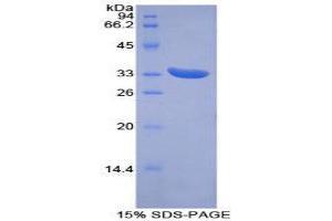 SDS-PAGE (SDS) image for PTEN Induced Putative Kinase 1 (PINK1) (AA 310-566) protein (His tag) (ABIN2126574)