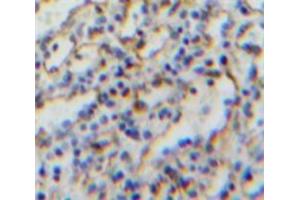 Immunohistochemistry (IHC) image for anti-Complement Component (3d/Epstein Barr Virus) Receptor 2 (CR2) (AA 729-957) antibody (ABIN1858487)