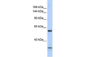 WB Suggested Anti-ZNF777 Antibody Titration:  0.