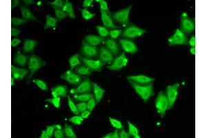 Immunofluorescence analysis of HeLa cells using ATXN3 antibody. (Ataxin 3 antibody)