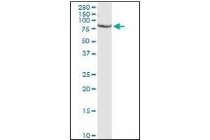 Western Blotting (WB) image for anti-Proprotein Convertase Subtilisin/kexin Type 1 (PCSK1) (AA 652-754) antibody (ABIN781869) (PCSK1 antibody  (AA 652-754))