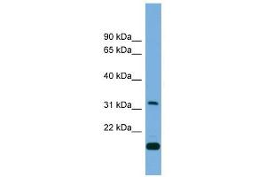 CTDSP2 antibody used at 1 ug/ml to detect target protein. (CTDSP2 antibody)