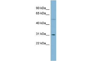 WB Suggested Anti-MRPL28  Antibody Titration: 0. (MRPL28 antibody  (Middle Region))