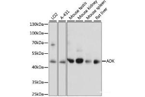 Western blot analysis of extracts of various cell lines using ADK Polyclonal Antibody at dilution of 1:1000. (ADK antibody)
