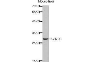 Western Blotting (WB) image for anti-CD79b Molecule, Immunoglobulin-Associated beta (CD79B) (AA 29-159) antibody (ABIN6219206) (CD79b antibody  (AA 29-159))
