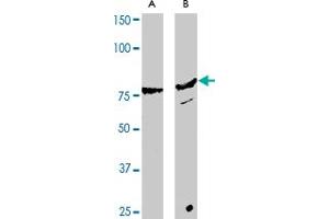 Western blot analysis of RHOBTB2 polyclonal antibody  expression in Hela (A) and A-431 (B) whole cell lysates. (RHOBTB2 antibody  (C-Term))