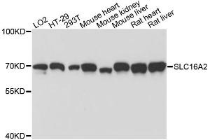 Western blot analysis of extracts of various cell lines, using SLC16A2 antibody. (SLC16A2/MCT8 antibody)