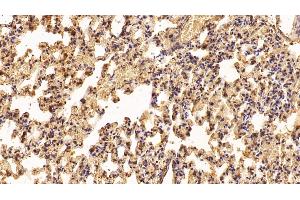 Detection of IFNa2 in Rat Lung Tissue using Polyclonal Antibody to Interferon Alpha 2 (IFNa2) (IFNA2 antibody  (AA 24-188))