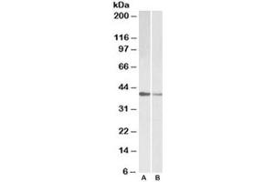 Western blot testing of human [A] and mouse [B] heart lysate with TNNT2 antibody at 0. (Cardiac Troponin T2 antibody)