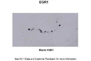 Sample Type : Frog brain Primary Antibody Dilution : 1:500 Secondary Antibody : Biotinylated goat anti-rabbit Secondary Antibody Dilution : 1:200 Color/Signal Descriptions : Black: EGR1 Gene Name : Egr1 a Submitted by : Eva Fischer, Colorado State University (EGR1 antibody  (C-Term))
