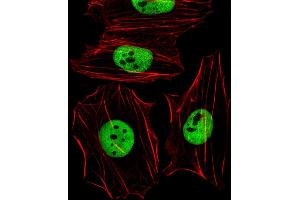 Fluorescent image of Hela cells stained with (Mouse) Smarcc1 Antibody (C-term) (ABIN6242636 and ABIN6577666). (SMARCC1 antibody  (C-Term))