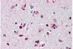 Human Brain, Cortex (formalin-fixed, paraffin-embedded) stained with ANP32A antibody ABIN461885 at 5 ug/ml followed by biotinylated goat anti-rabbit IgG secondary antibody ABIN481713, alkaline phosphatase-streptavidin and chromogen. (PHAP1 antibody  (N-Term))