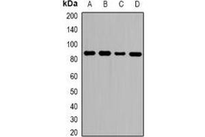 Western blot analysis of ZNF839 expression in HeLa (A), MCF7 (B), RAW264. (ZNF839 antibody)