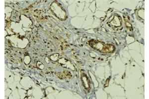 ABIN6278698 at 1/100 staining Human lung tissue by IHC-P. (GLI3 antibody  (Internal Region))