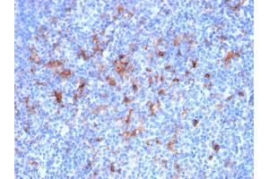 Formalin-fixed, paraffin-embedded human Tonsil stained with CD25 Mouse Monoclonal Antibody (IL2RA/2395). (CD25 antibody  (AA 42-183))